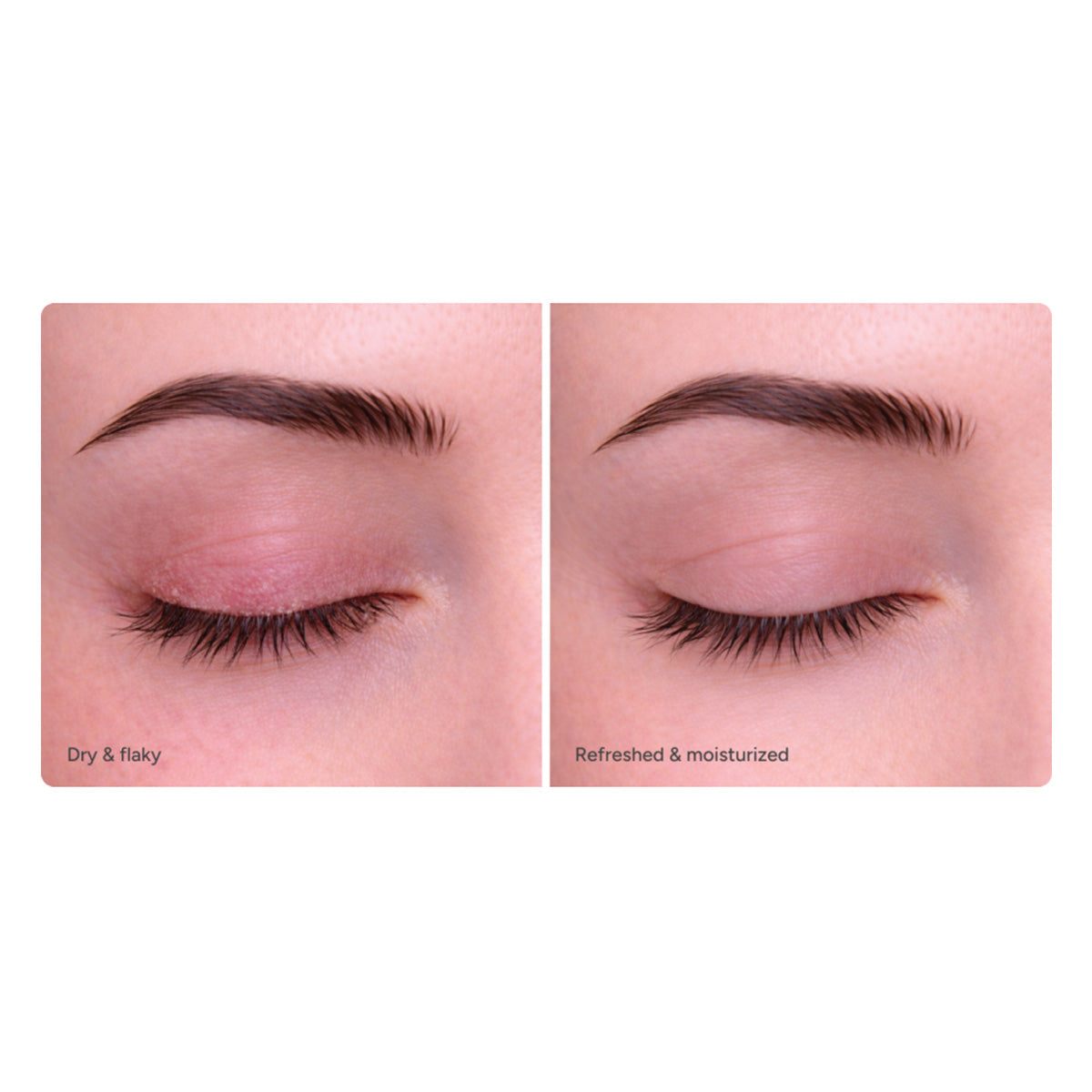 Ndemex Revitalizing Eye Serum