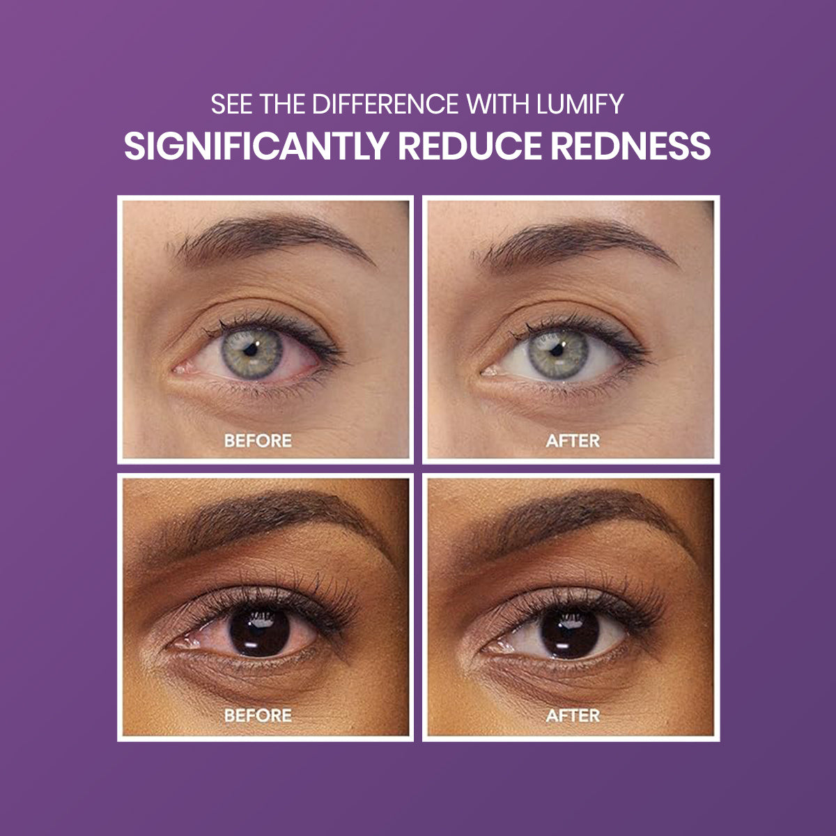 Image shows before and after eye photos. Top: lighter-skinned eyes with redness before, clearer after. Bottom: darker-skinned eyes with redness before, clearer after. Text: Experience the difference with Bausch & Lomb Lumify Eye Drops 2.5mL and 7.5mL.