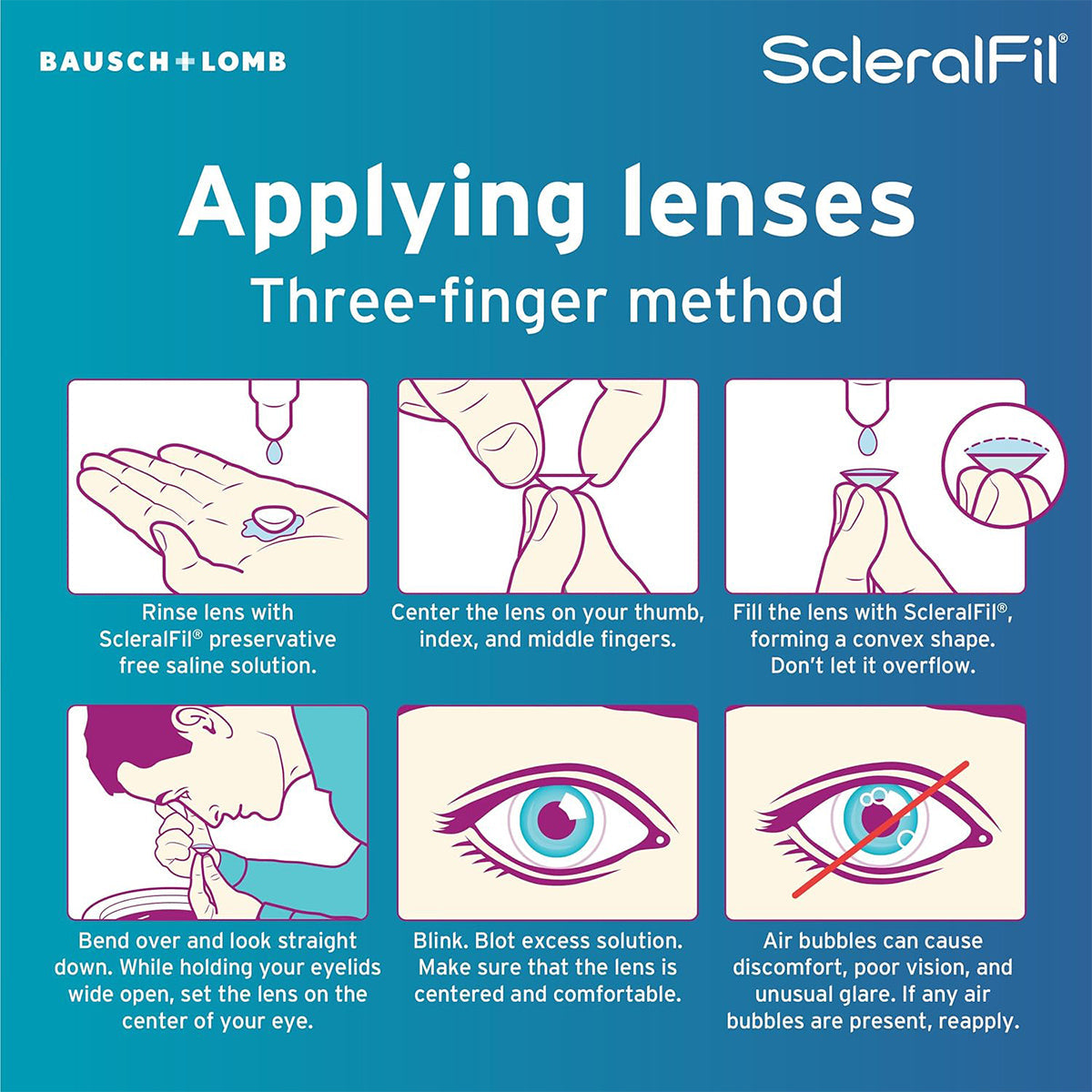 Instructions for applying scleral lenses with the three-finger method: Rinse lenses, center on fingers, fill with Bausch + Lombs ScleralFil Preservative-Free Saline Solution, bend over and insert while blinking. Check for bubbles. Trusted branding ensures comfort and clarity.