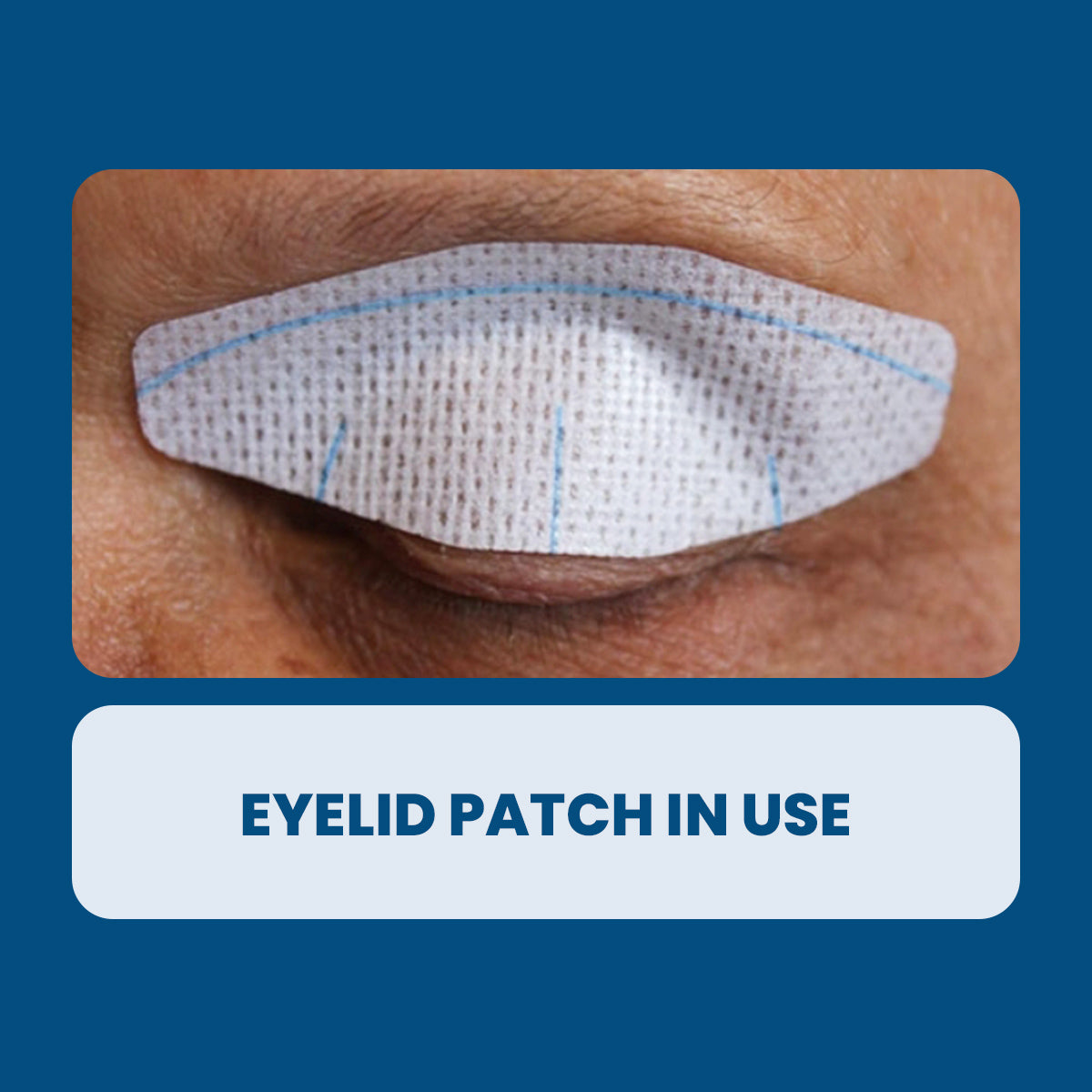 A close-up displays a persons closed eye with a Nictavi adhesive patch ensuring eyelid closure. The blue background features text reading EYELID PATCH IN USE. This helps protect the cornea and provides relief for dry eyes using Nictavi Disposable Device for Nighttime Eye Lid Closure (15ct).