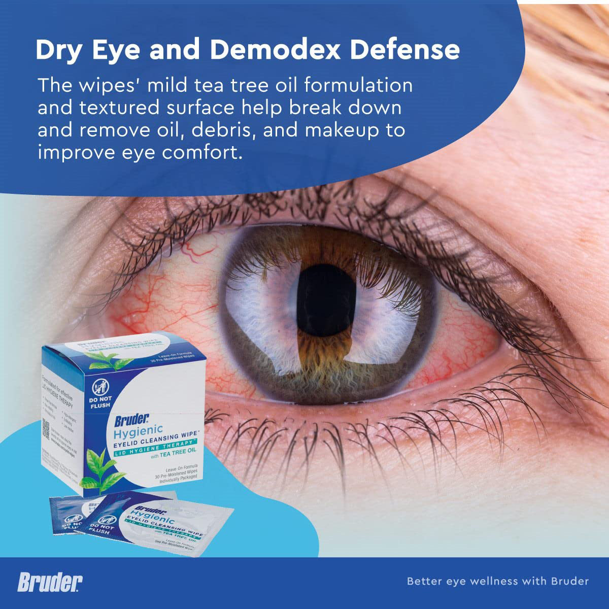 A close-up of an irritated, red eye promotes Bruder Hygienic Eyelid Cleansing Wipes with Tea Tree Oil (30ct) for combating dry eye and demodex. The packaging highlights improvements in ocular irritation and comfort through optimal eyelid hygiene.