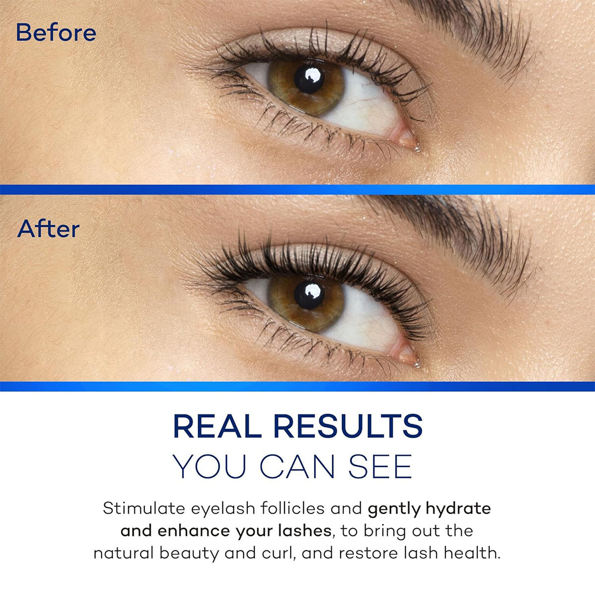 Close-up of an eye with highlighted lashes—top shows lashes before ZocuLash Eyelash Enhancing Serum (2.5mL) by Zocular, bottom shows longer, fuller lashes after use. Text: Real Results You Can See with benefits for lash health, ideal for sensitive eyes.