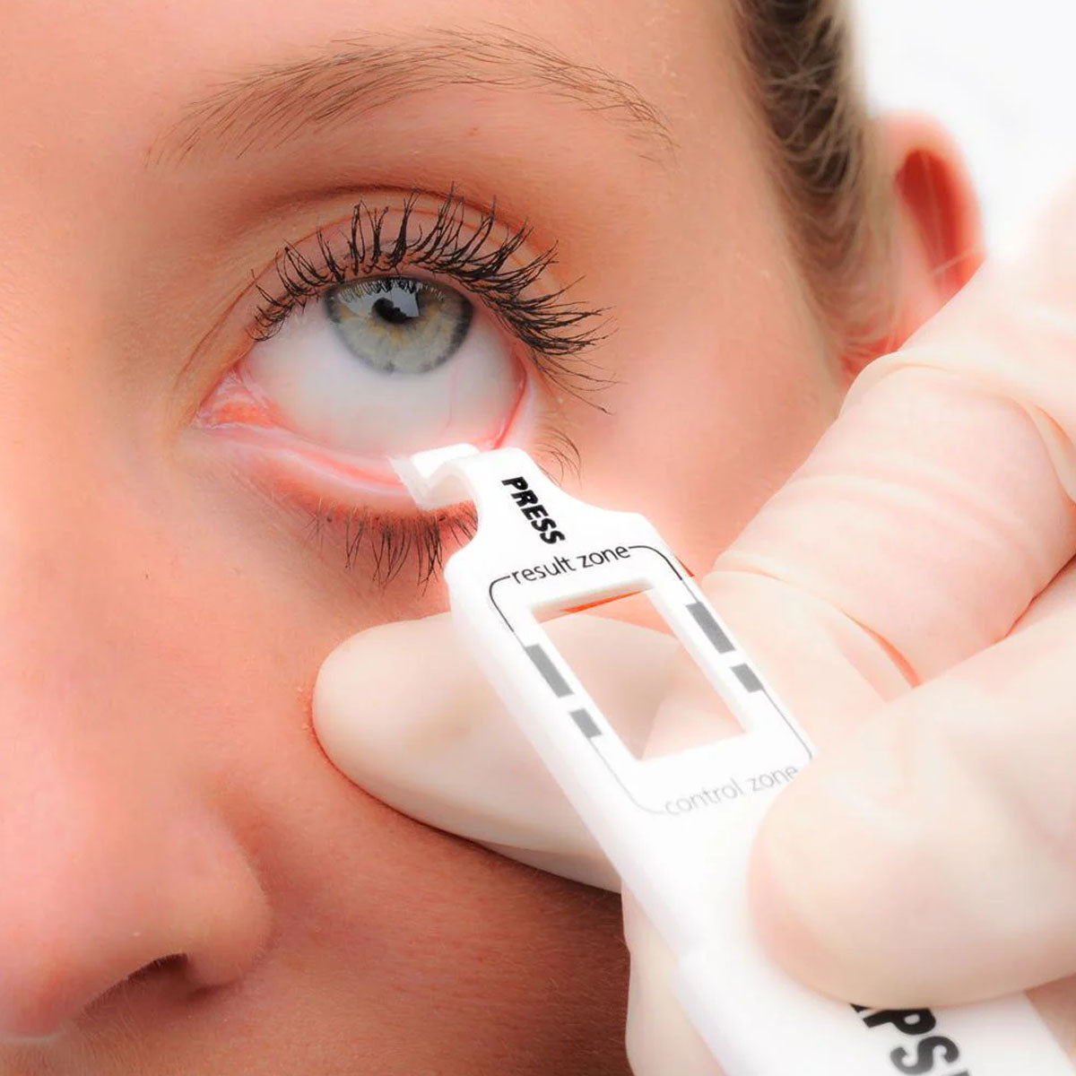 Inflammadry MMP-9 Testing (20-Pack) In-Office Testing