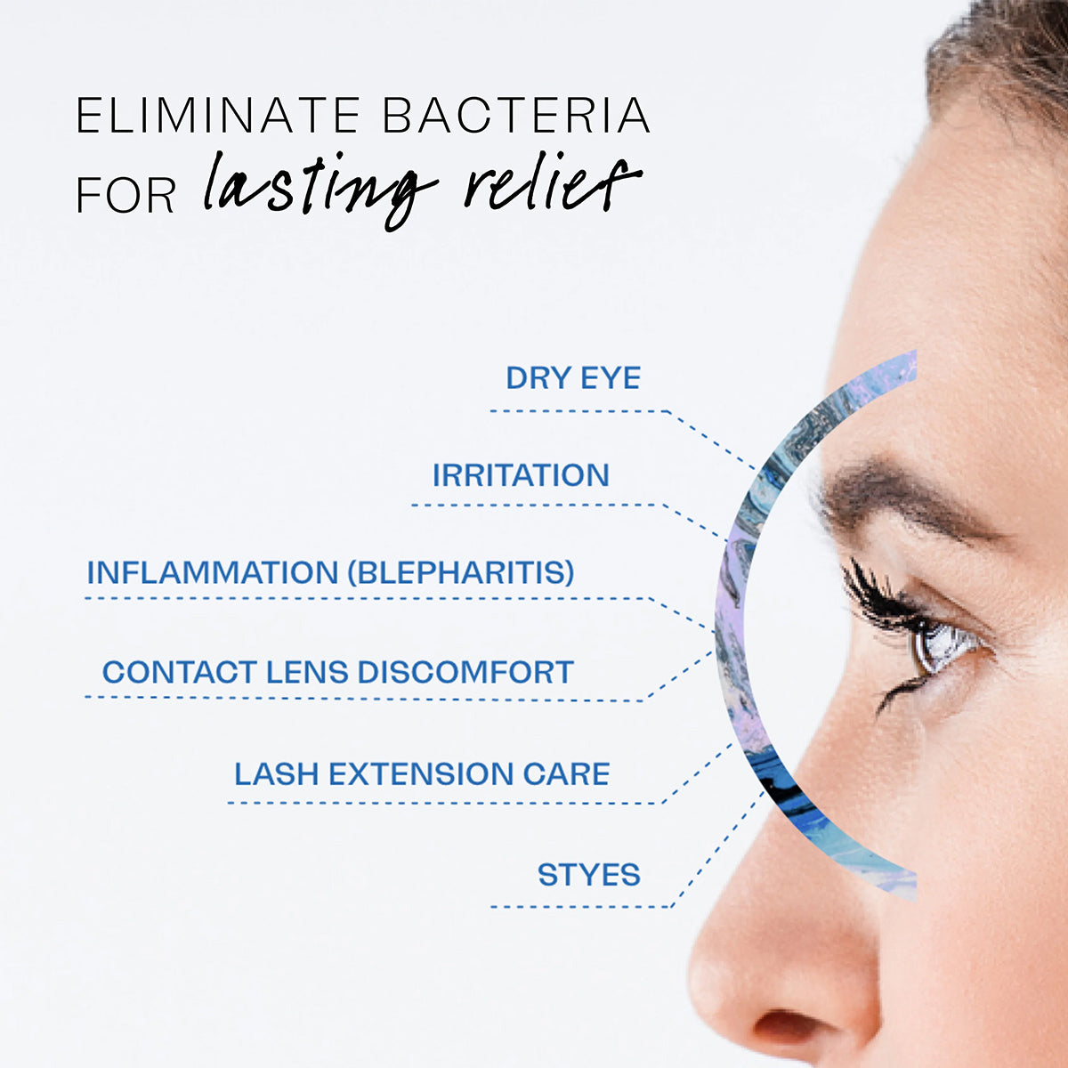 Close-up of a womans eye with text: Eliminate bacteria for lasting relief. Arrows point to Dry Eye, Irritation, Inflammation (Blepharitis), Contact Lens Discomfort, Lash Extension Care, Styes. Try NovaWipes pads for use with Avenova Spray by NovaBay for gentle eyelid care.