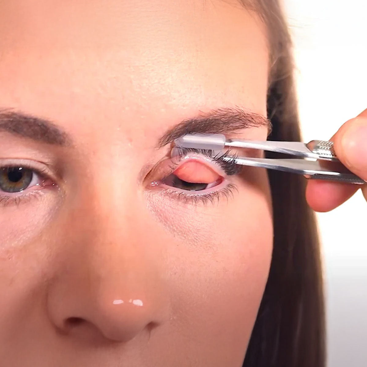 Meivertor™ Starter Kit – Stainless Steel Handle + 100 Single-Use Disposable Tips for Eyelid Eversion