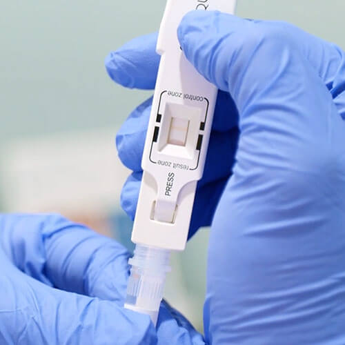 A person wearing blue gloves holds a white plastic test device, with labeled control zone and result zone sections. They are inserting a sample using a small tube at the bottom of the device.