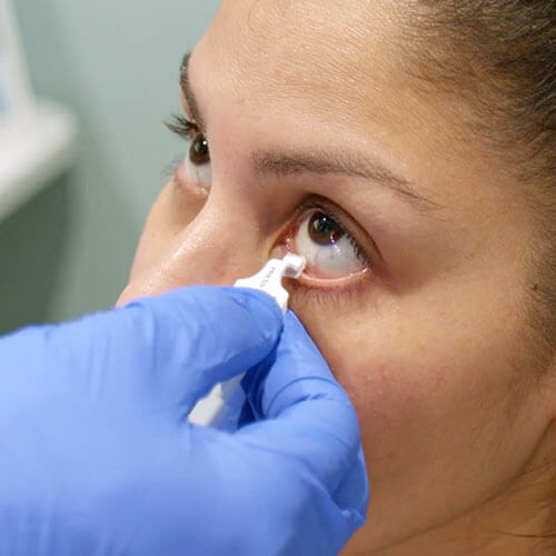 A person is receiving eye treatment. A hand wearing a blue glove applies white ointment or eye drops to the person’s lower eyelid. The person looks upward, and the background is out of focus.