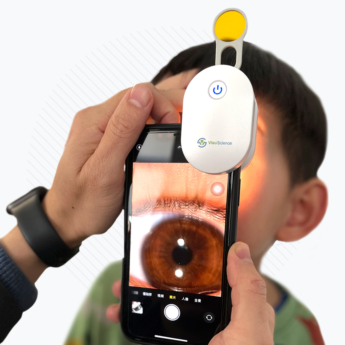Using the VisuScience QuikVue Plus Smartphone Imaging Adapter, a parent performs a primary eye care exam on their child. The phone screen shows a close-up of the childs eye as another hand holds the device, featuring a glowing button and yellow light for detailed anterior segment imaging.