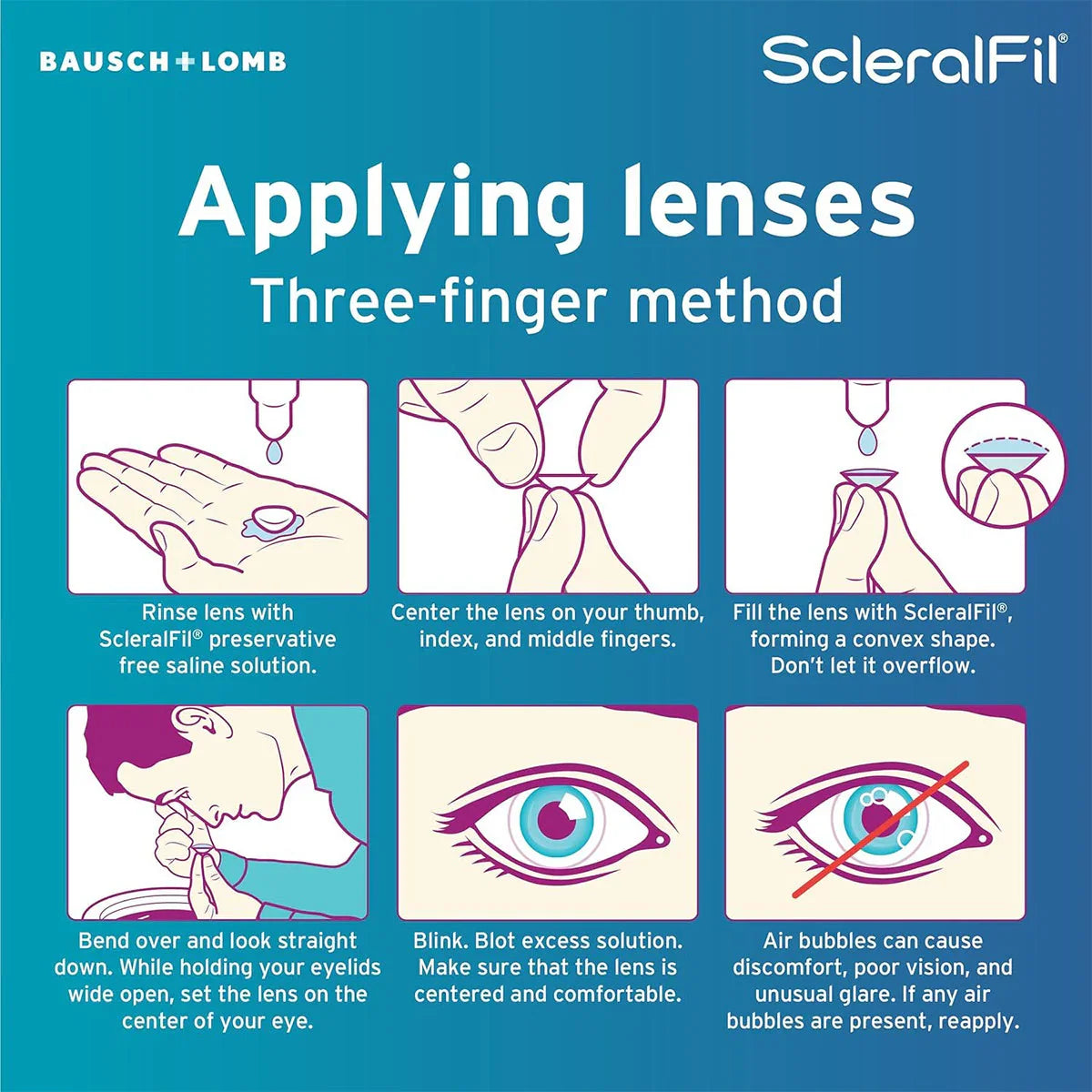 ScleralFil Preservative Free Saline Solution for Scleral, Soft, & Rigid Gas Permeable Lenses, Buffered Solution, Single-Use Vials, 0.33 Fl Oz (10 mL) Pack of 30