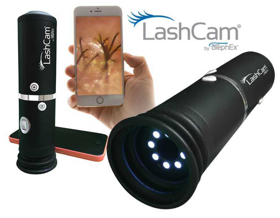 Image of the Blephex Eyelid Biofilm Remover device, featuring a close-up lens with LED lights for optimal eyelid hygiene. The device stands next to a smartphone showing detailed eyelash and skin images, ideal for those undergoing the BlephEx procedure.