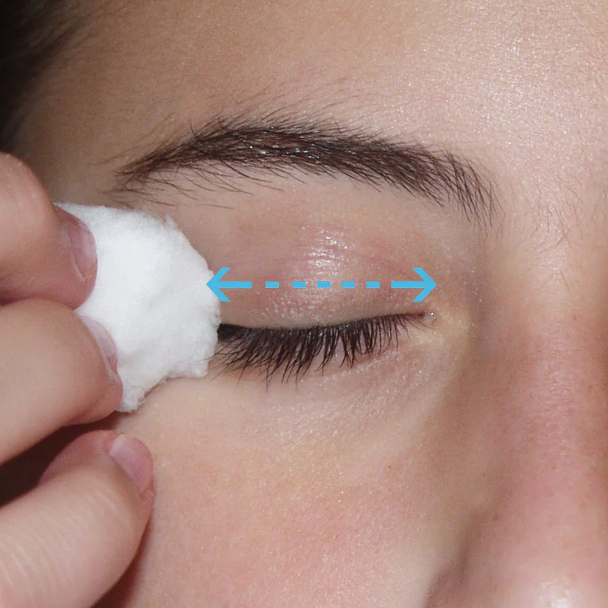 A person uses a cotton pad with LidHygenix Gentle Foam Eyelid Cleanser against their closed eye. Blue arrows suggest horizontal motion for cleaning and makeup removal. Its hypoallergenic formula supports eye health, smooth skin, and visible lashes.