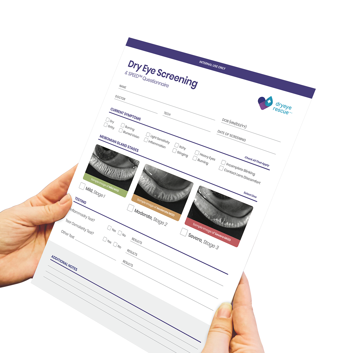 SPEED Score - Dry Eye Screening/Referral Forms (500 Sheets, 10 Pads of 50)