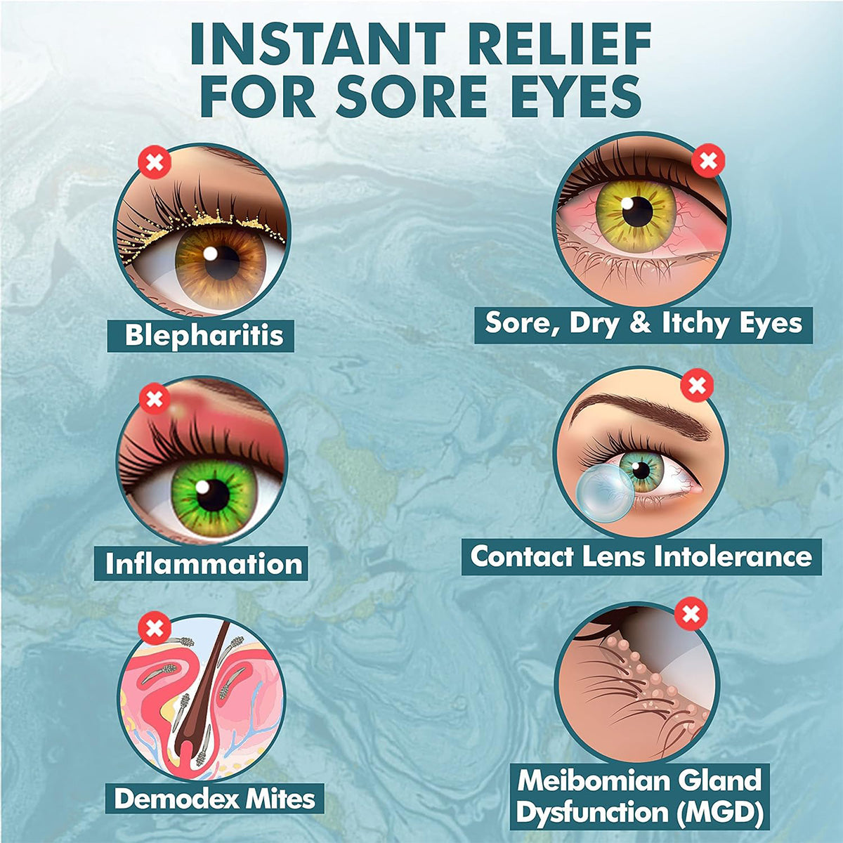 Infographic titled Instant Relief for Sore Eyes illustrates Blepharitis, Sore/Dry/Itchy Eyes, Inflammation, Contact Lens Intolerance, Demodex Mites, and Meibomian Gland Dysfunction (MGD) with red crosses. Highlights Noveha Hypochlorous Acid Eyelid and Lash Cleanser (30mL) as an effective relief solution.