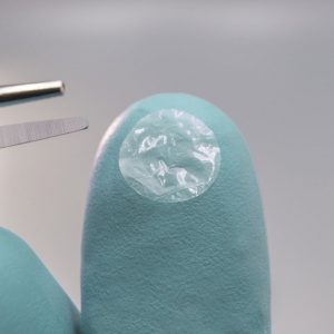Eclipse Dehydrated Dual Layer Amniotic Membrane by Ophthalogix