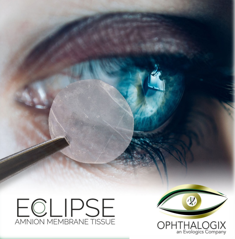 A close-up shows a blue eye being fitted with a thin transparent membrane using tweezers. This Eclipse Dehydrated Dual Layer Amniotic Membrane from Ophthalogix enhances healing, with both the product and brand logos displayed at the bottom.