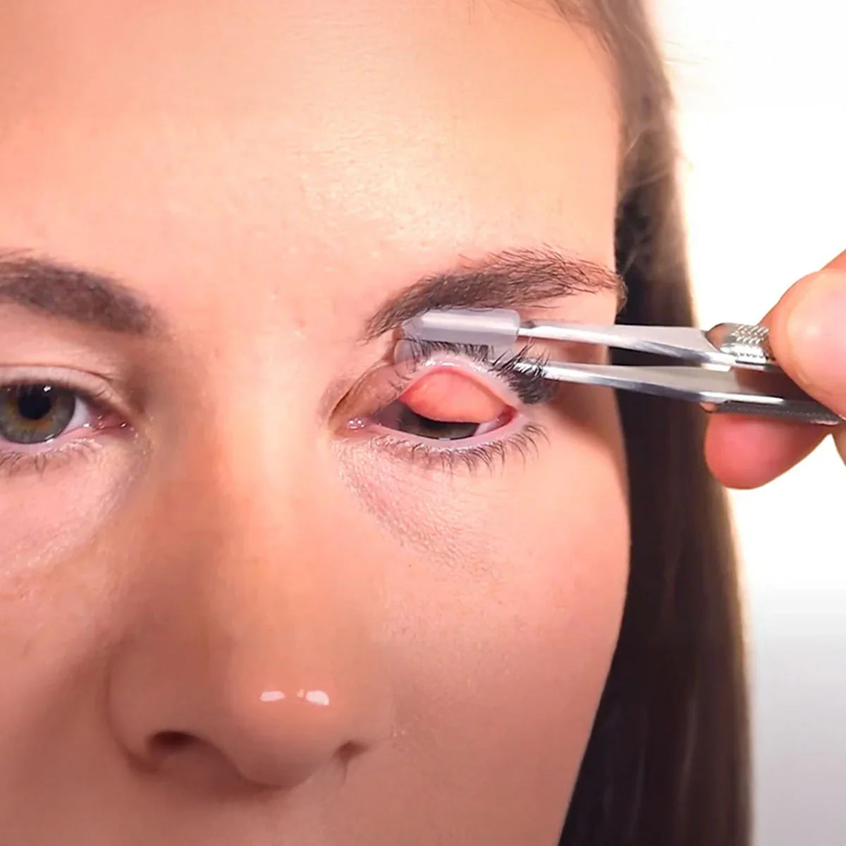 Meivertor™ Replacement Tips – 100 Single-Use Disposable Tips for Hygienic Eyelid Eversion