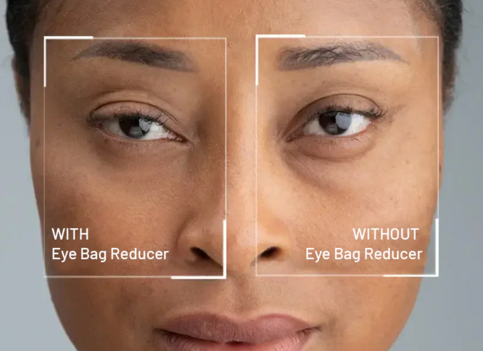 EyeDerm Eye Bag Reducer Cream for dry, tired and puffy eyes